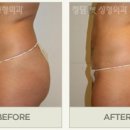 청담미의원 이미지