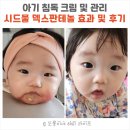 아기 침독 속건조 피부 장벽 무너짐 해결 - 시드물 덱스판테놀 효과 및 후기