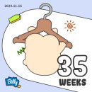 부천서울여성병원 제왕절개 36주 출산 입원실 후기 태아서맥 면회시간