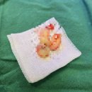 (주)알엠퍼스트 | 인계동 퍼스트사랑니치과 사랑니 발치 후기 🦷