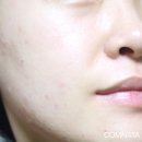 큐어시스 이미지