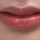 청담차오름의원 이미지