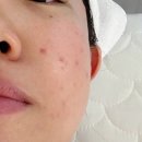 부평 피부관리 제대로 받고 온 브이메디스파 후기 예민 피부 진정관리 만족!