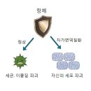 다발성 경화증Multiple sclerosis뇌신경정신질환 이미지