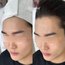 서면왁싱 깔끔하게 관리 가능한 멜로드뷰티 후기