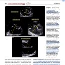 고양이 RCM의 clinical, epidemiological, 심초음파 상 features 및 예후인자 이미지