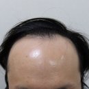 방지성에이스의원 이미지