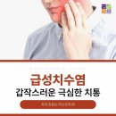 세븐일레븐구미가톨릭병원점 | 구미치과추천 갑작스러운 치통 폭발 급성치수염 원인과 3가지 단계별 증상
