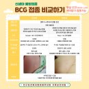 신생아예방접종 BCG비교하기 이미지