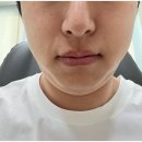 청담밴스의원 | 청담밴스의원 레이저제모 > 젠틀맥스프로플러스 깔끔해요!