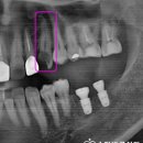 송탄이치과의원 이미지