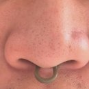 영플러스메디칼 이미지