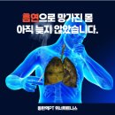 U_만성질환관리센터(동탄) | 흡연 알고 계신다면 피우지 못하실 겁니다. 동탄역PT 위너휘트니스