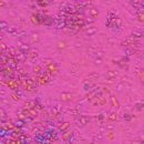 더본마취통증의학과의원 | 통풍? 가성통풍? 치료 진단 수원 더본마취통증의학과