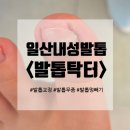 (주)바로닥터 | 일산발톱관리 &#39;발톱닥터&#39; 내성발톱 김수연매니저추천 솔직후기
