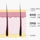 헤드샷스칼프제이닷