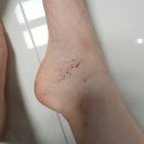 오르소한의원 | 계류유산한약 산후 유산보약 오르소한의원 내돈내산 후기