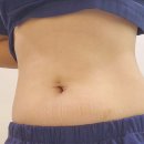 버블멍(니즈더펫) | [세종/나성동] 다이어터의 리얼한 고민 해결! 제로펫주사로 가볍고 매끈한 라인 만들기 (1회차 솔직 후기)