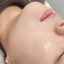 뷰앤비클럽 | 청주왁싱샵추천 뷰앤비클럽왁싱 청주산남점 풀페이스왁싱 후기