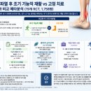 For the cl | Early functional rehabilitation compared with traditional immobilization for acute Achilles tendon