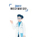 위례포에버의원 | 검버섯? 지루각화증? 원인과 효과적인 치료 방법