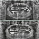 밝은웃음치과의원 이미지