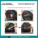 파주운정 운정탈모관리 두피스케일링 추천 후기 정보 닥터모다르