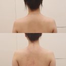 채움에스테틱 네이버블로그