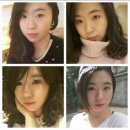 쌍수비포애프터,절개 쌍커풀 수술, 직장인 쌍수 후기 (쌍수 재수술) 호박즙추천,