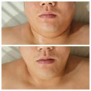 (내돈내산) 군산 수송동 피부관리실 - 두리스킨케어 후기