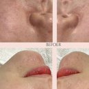 퀸에스테틱 이미지