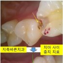 정도치과기공소 이미지