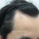 모먼트의원 이미지