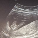 리움여성의원 이미지