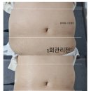 뷰리에스킨케어 이미지