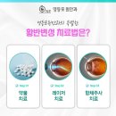 네모안경콘택트 이미지