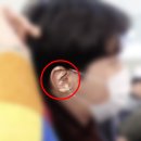 귀로 보는 건강클리닉 이혈 | 이혈패치, 연예인도 쓰는 귀지압패치 붙이고 예쁨 까지 잡는 법