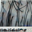 BG독케어센터 | 부평탈모·인천 두피관리 - 머리 빠지고 가려울때, 닥터모락 작전점 솔직후기