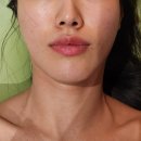 인루나 에스테틱