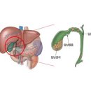 커피 많이 마시면 담석 위험↓ 외~~ 이미지