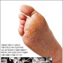 효소와발이야기 이미지