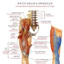 대퇴신경: 대퇴신경압착증후군 이미지