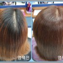 큐케어 이미지