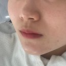 피부결 살아나는 양산피부관리샵 올가드림뷰티 이지더원5차점 체험기! 모공청소 받고 놀란 피부 변화 ✨