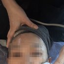 수네에스테틱