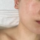 카라피부관리샵 | 구미 피부관리샵 어여쁘다 엑스퍼젯스킨부스터 후기