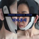 브이라인 리프팅밴드 예비신부 홈케어 티마뷰티 후기