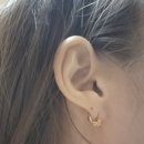 걱정말고 그려봐 | 논현동 귓볼 찢어짐 봉합수술 후기! 거의 찢어지기 직전이라 다녀왔어요