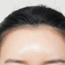 바람부는날에도 성형외과의원 이미지