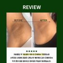 청담제이의원 | ✨ 지흡 후 겨드랑이 색이 더 진해졌다면? 방치하면 늦습니다